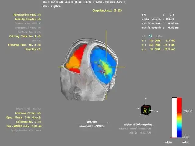 ابزار وب یا برنامه وب 3DBrainExplorer را دانلود کنید