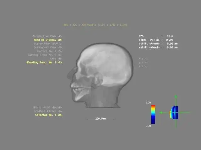 Загрузите веб-инструмент или веб-приложение 3DBrainExplorer.