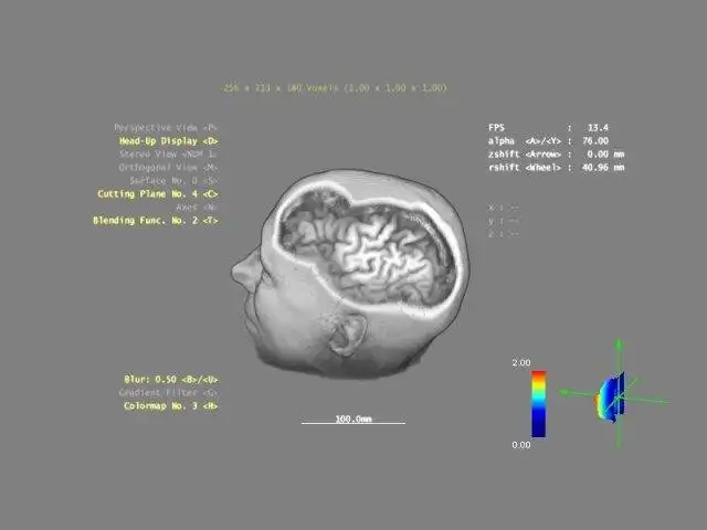 Muat turun alat web atau aplikasi web 3DBrainExplorer