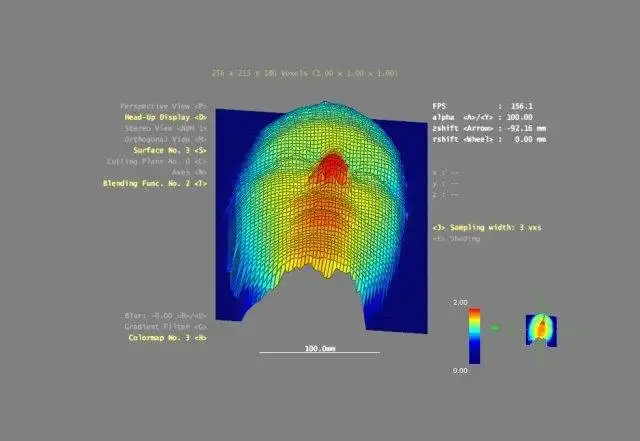 വെബ് ടൂൾ അല്ലെങ്കിൽ വെബ് ആപ്പ് 3DBrainExplorer ഡൗൺലോഡ് ചെയ്യുക