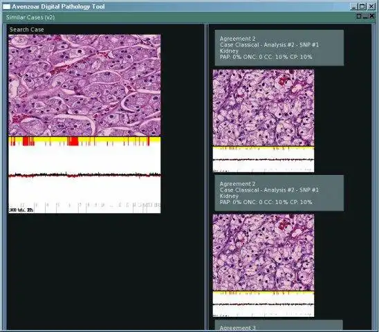 웹 도구 또는 웹 앱 다운로드 Avenzoar Digital Pathology Tool