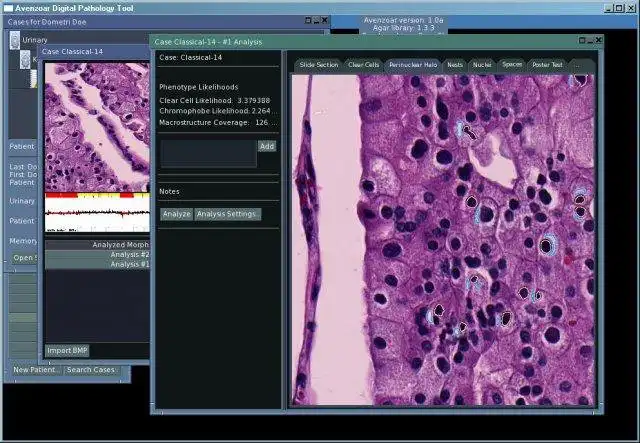 دانلود ابزار وب یا برنامه وب Avenzoar Digital Pathology Tool
