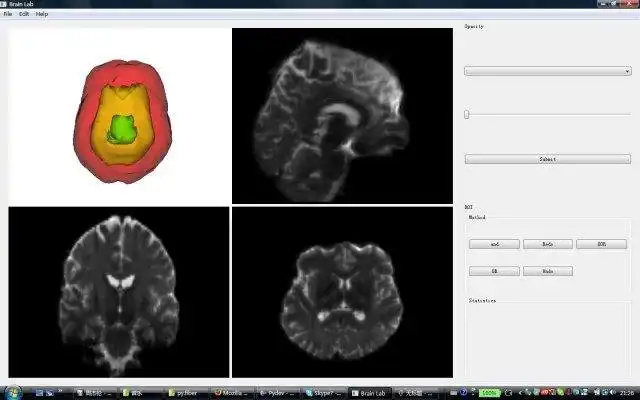 웹 도구 또는 웹 앱 BrainLab 다운로드