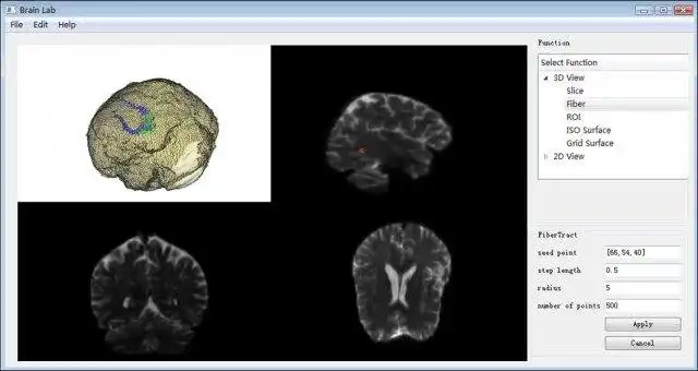 Download web tool or web app BrainLab