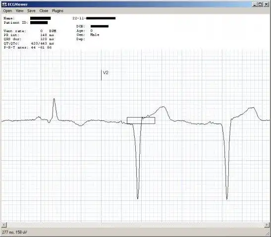 下载网络工具或网络应用程序 C# ECG 工具包