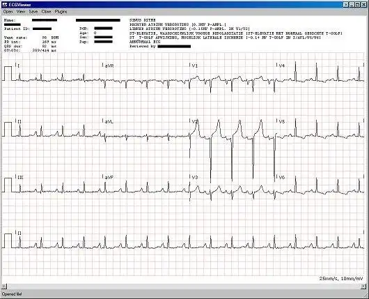 下载网络工具或网络应用程序 C# ECG 工具包