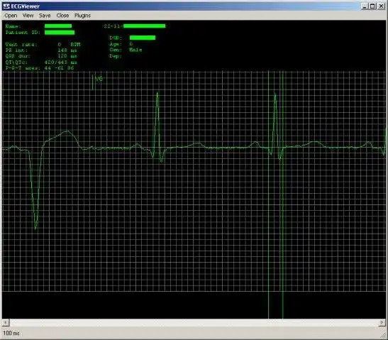 下载网络工具或网络应用程序 C# ECG 工具包