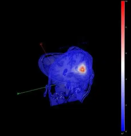 ওয়েব টুল বা ওয়েব অ্যাপ CTF-SAM-OUT, সুপারপোজিং CTF SAM এবং MRI ডাউনলোড করুন