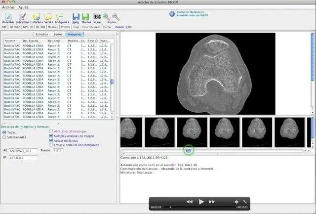 Загрузите веб-инструмент или веб-приложение DCM4CHEE Java Viewer Lite