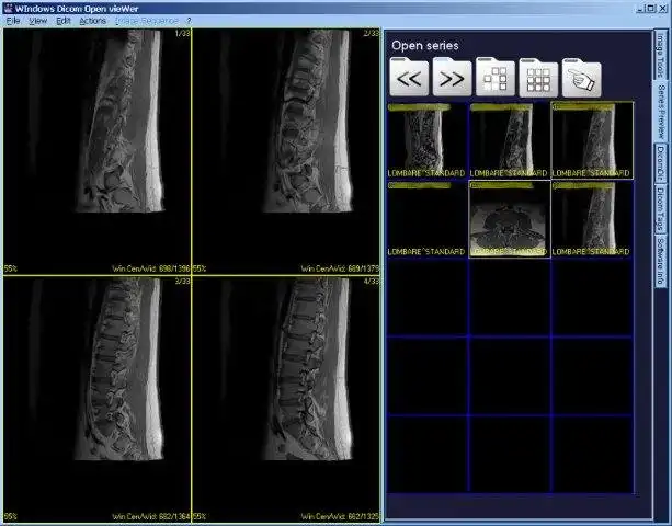 Unduh alat web atau aplikasi web Dicom Widow