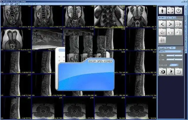 Download web tool or web app Dicom Widow