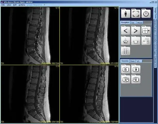 Laden Sie das Web-Tool oder die Web-App Dicom Widow herunter