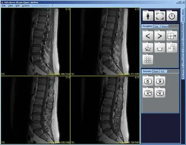 Download web tool or web app Dicom Widow to run in Windows online over Linux online