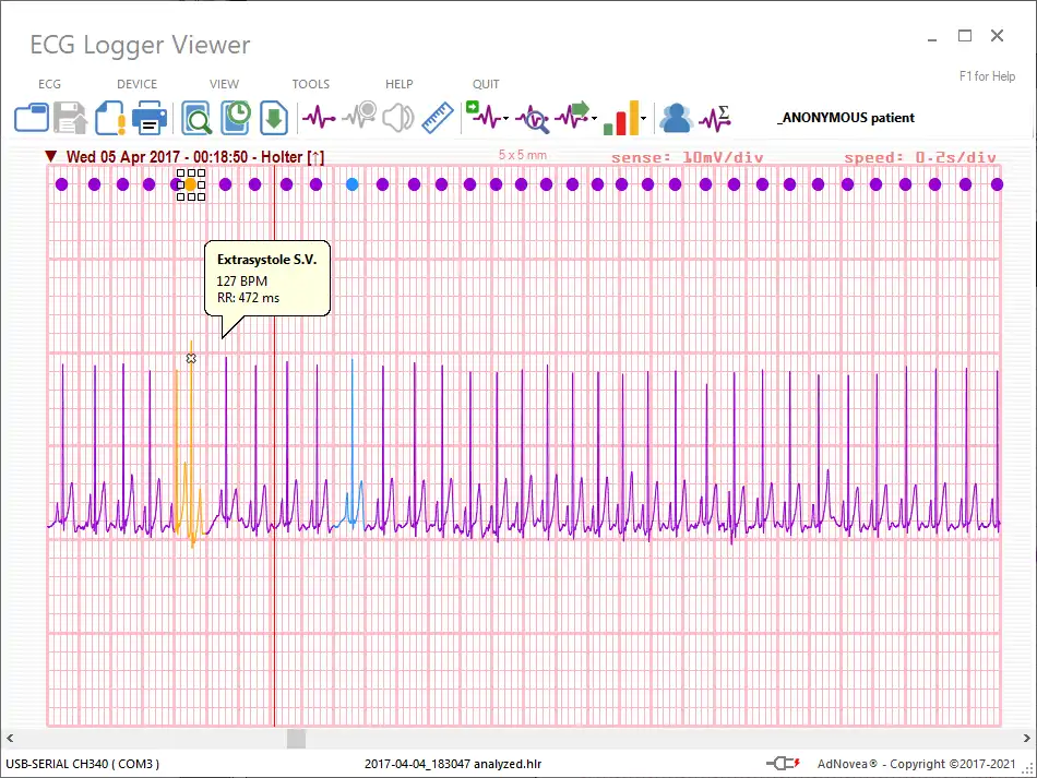 웹 도구 또는 웹 앱 ECG 로거 뷰어 다운로드