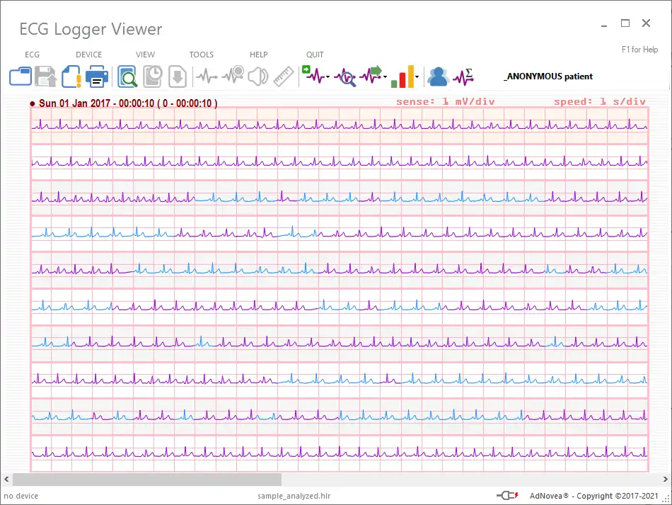 Laden Sie das Web-Tool oder die Web-App ECG Logger Viewer herunter