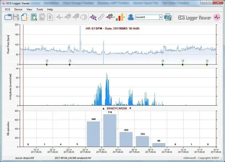 웹 도구 또는 웹 앱 ECG 로거 뷰어 다운로드