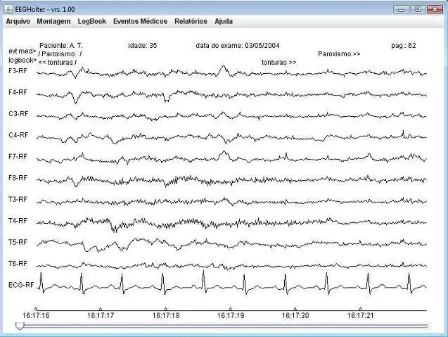 Muat turun alat web atau aplikasi web EEG-Holter
