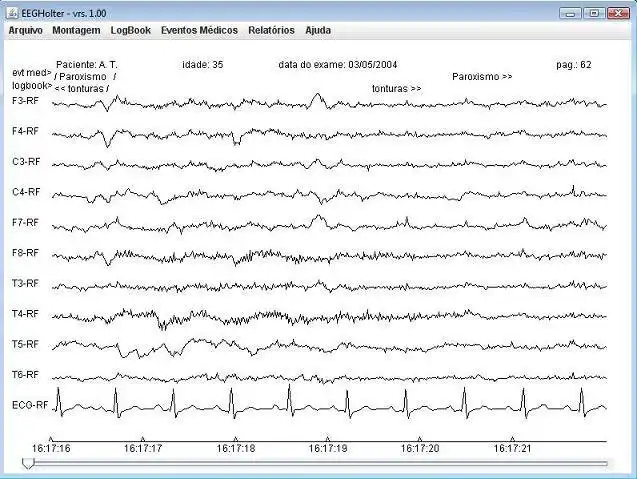 Descărcați instrumentul web sau aplicația web EEG-Holter