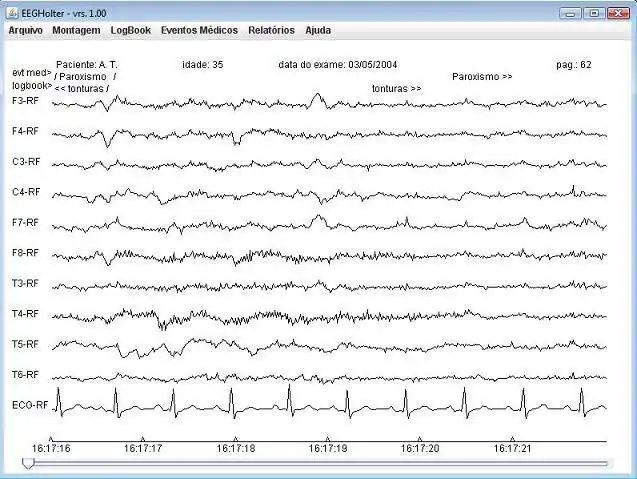 Download web tool or web app EEG-Holter to run in Linux online