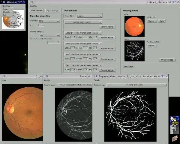 Download web tool or web app HM integration for vessel segmentation to run in Windows online over Linux online