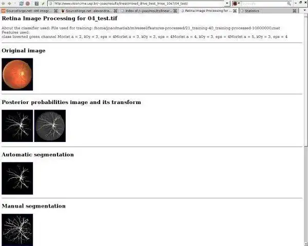 Download web tool or web app HM integration for vessel segmentation to run in Windows online over Linux online