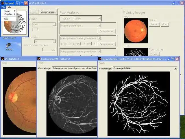 Download web tool or web app HM integration for vessel segmentation to run in Windows online over Linux online