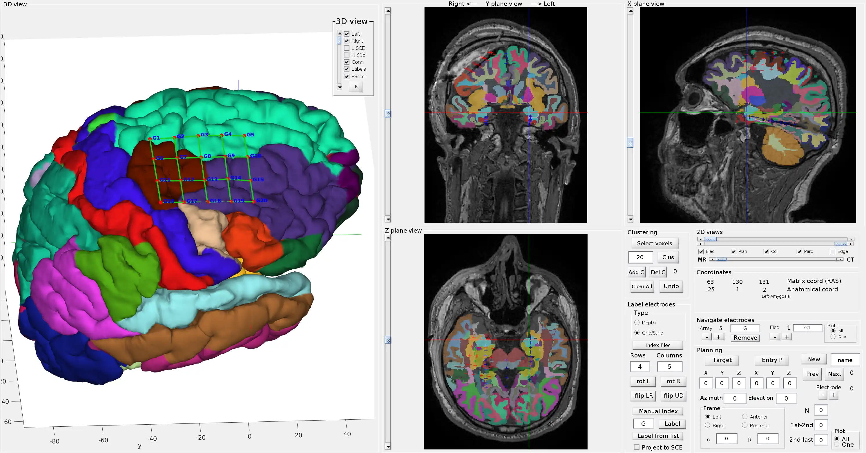 Download webtool of webapp iElectrodes