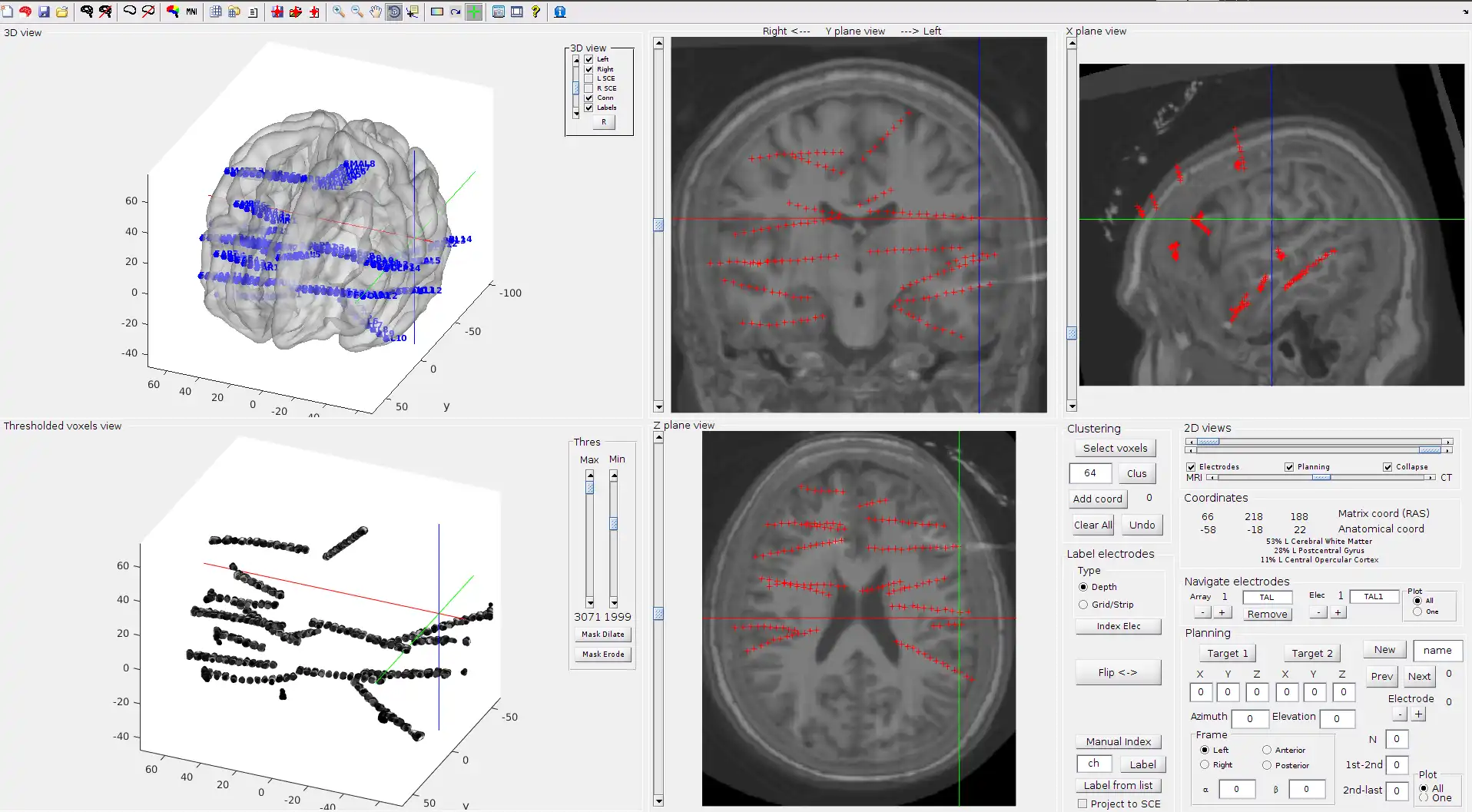 Download web tool or web app iElectrodes