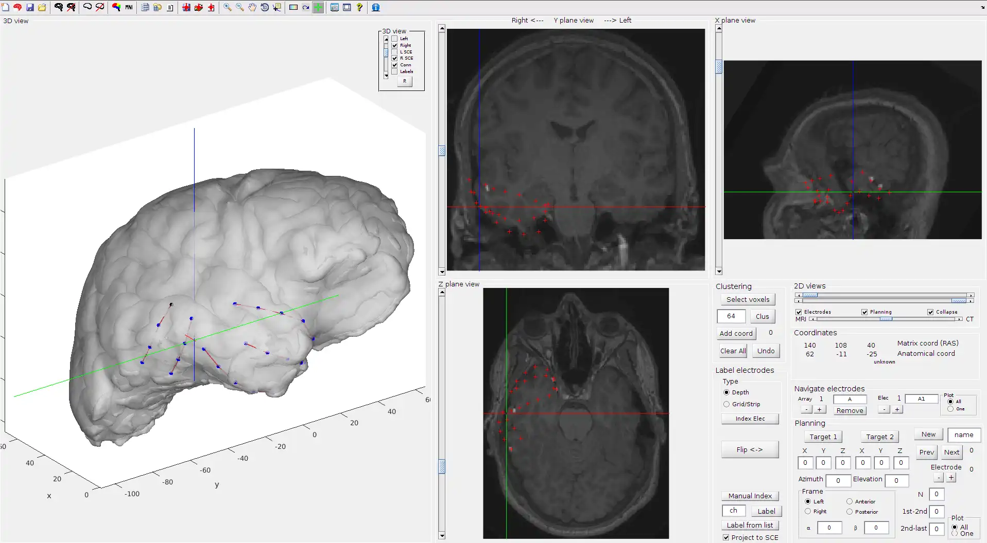 Download webtool of webapp iElectrodes