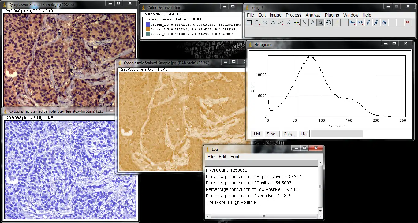 웹 도구 또는 웹 앱 IHC 프로파일러 다운로드