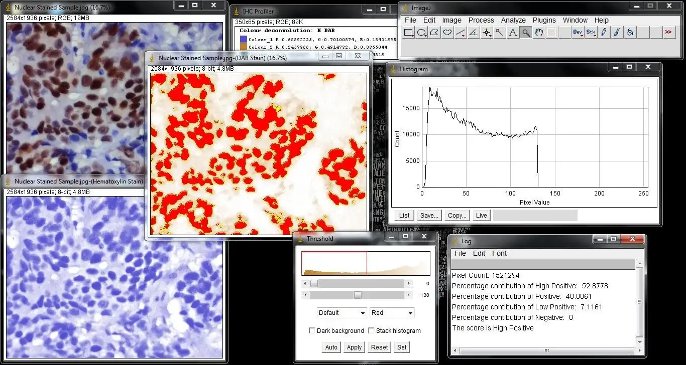 웹 도구 또는 웹 앱 IHC 프로파일러 다운로드