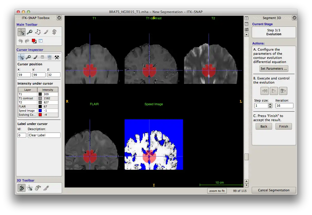 Laden Sie das Web-Tool oder die Web-App ITK-SNAP Medical Image Segmentation Tool herunter