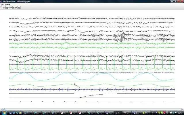 Download web tool or web app jBioSignal to run in Linux online