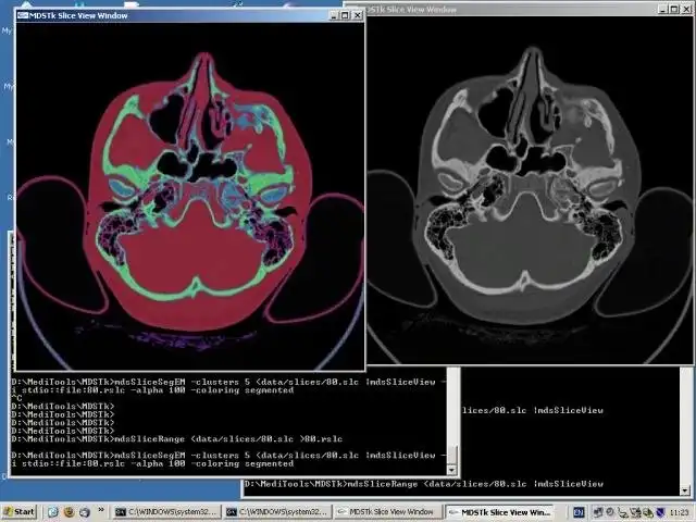 Descargue la herramienta web o la aplicación web Kit de herramientas de segmentación de datos médicos