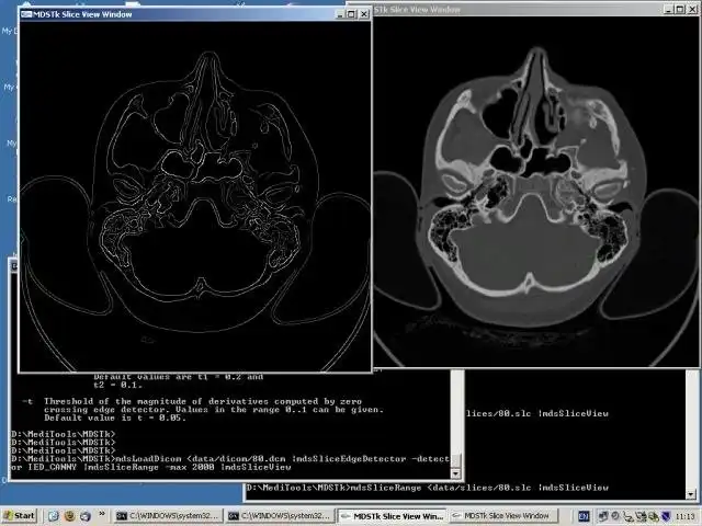 Download webtool of webapp Medical Data Segmentation Toolkit