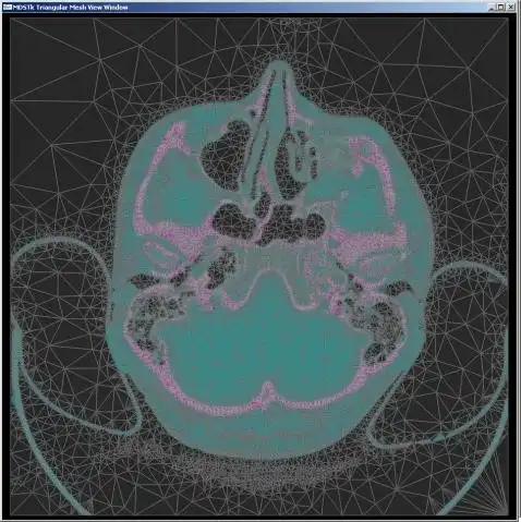 Download web tool or web app Medical Data Segmentation Toolkit