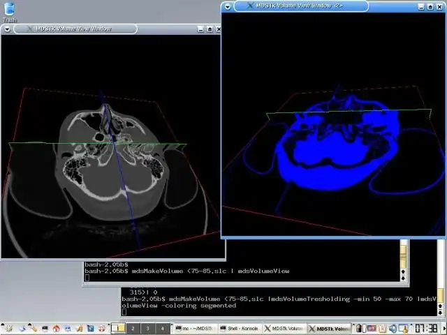 Scarica lo strumento web o l'app web Medical Data Segmentation Toolkit