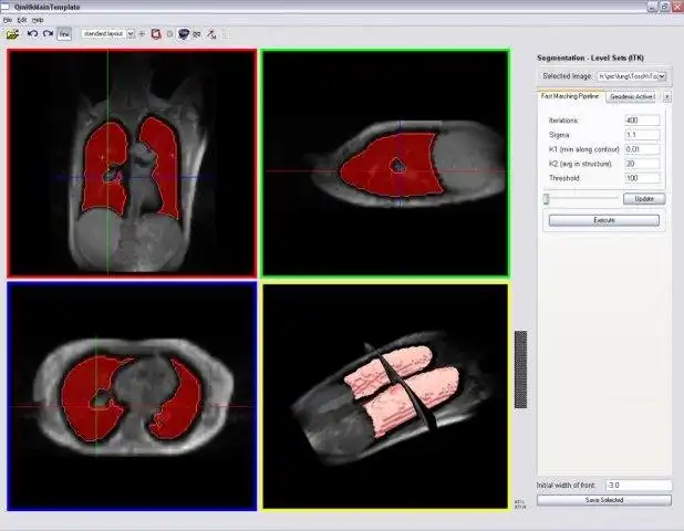 Download web tool or web app MITK