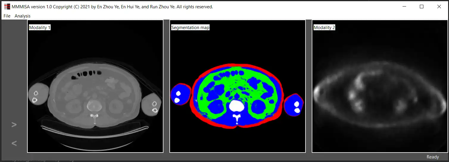 Download web tool or web app MMMISA