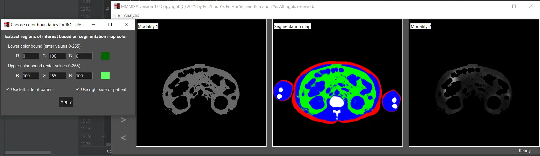 Download webtool of webapp MMMISA