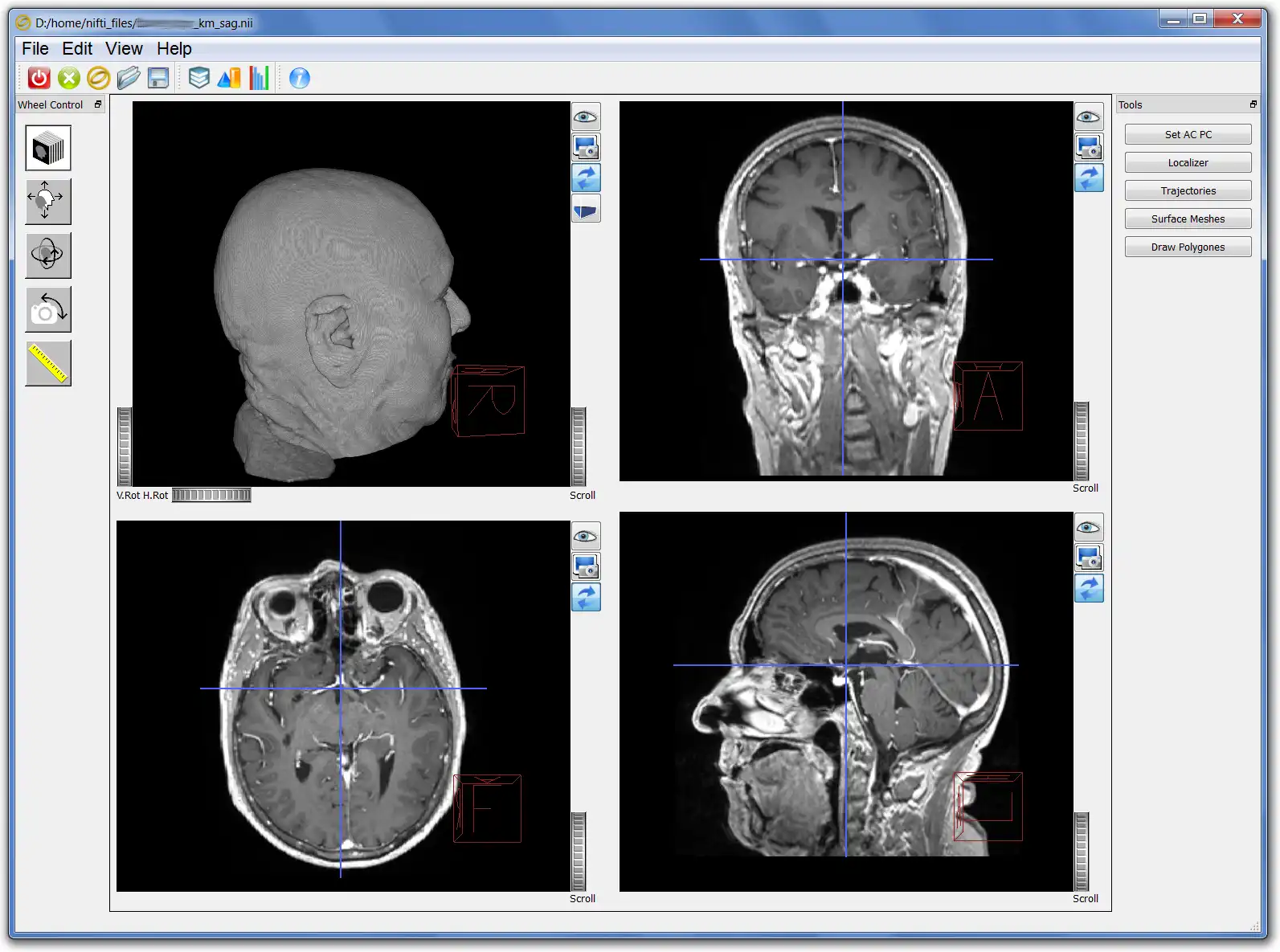 Download web tool or web app Ogles -  OpenGL/OIV  stereotactic tool to run in Linux online