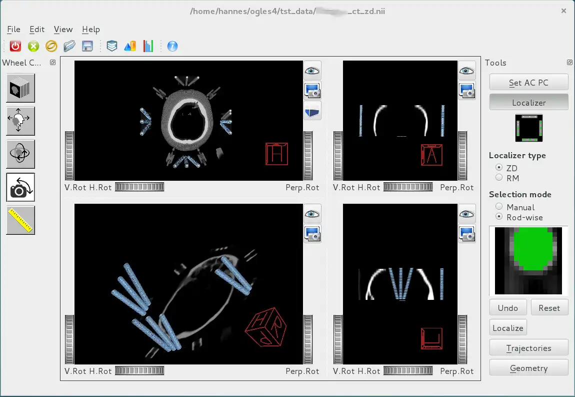 Download web tool or web app Ogles -  OpenGL/OIV  stereotactic tool to run in Linux online