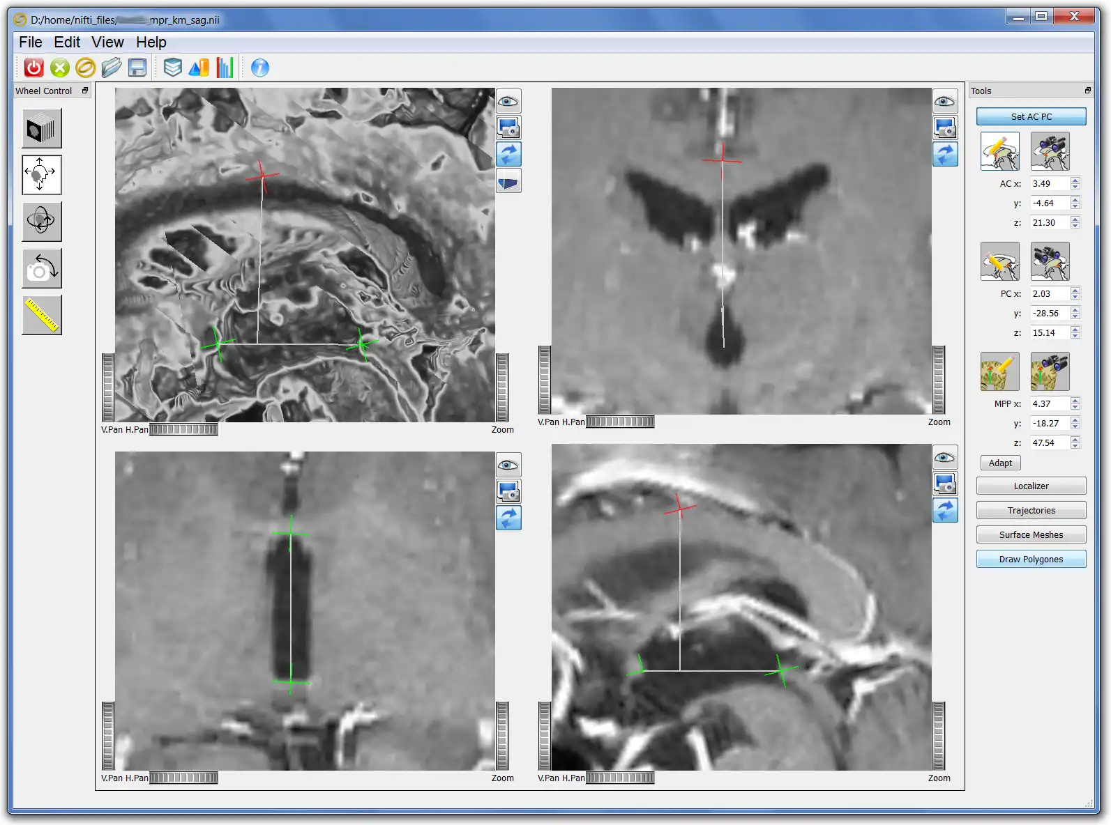 Download web tool or web app Ogles -  OpenGL/OIV  stereotactic tool to run in Linux online