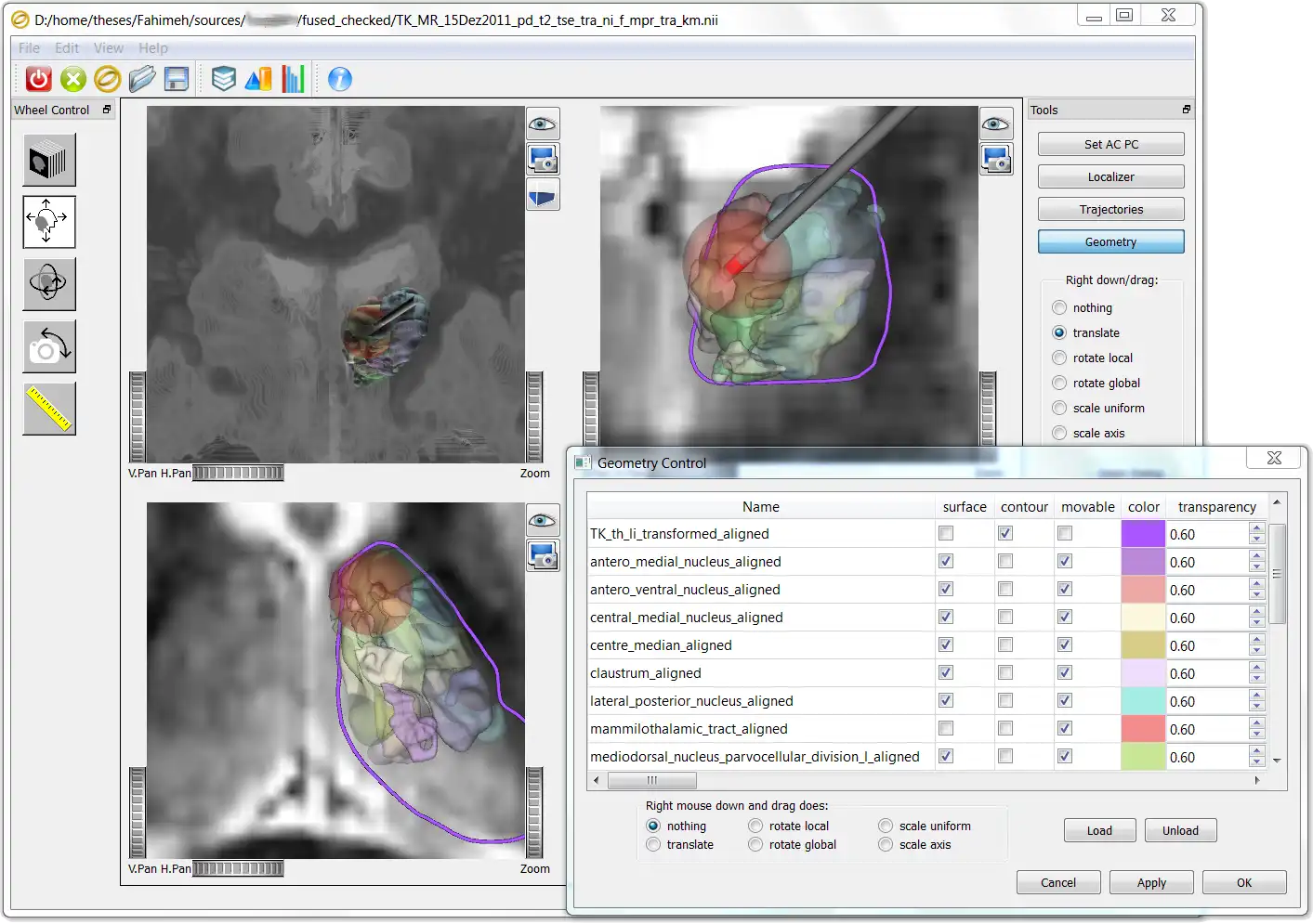 Download web tool or web app Ogles -  OpenGL/OIV  stereotactic tool to run in Linux online