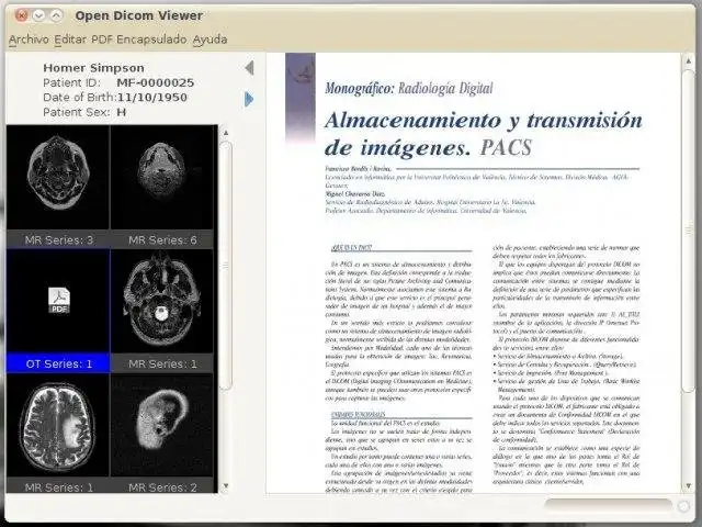 Загрузите веб-инструмент или веб-приложение Open Dicom Viewer