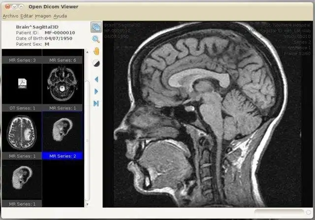 Download web tool or web app Open Dicom Viewer