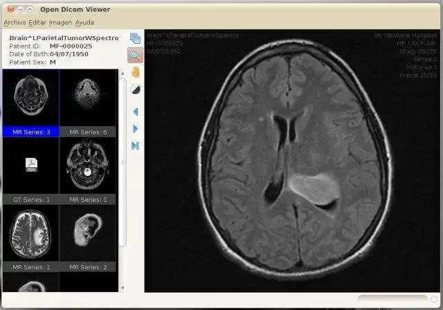 Загрузите веб-инструмент или веб-приложение Open Dicom Viewer