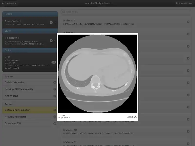 Download webtool of webapp Orthanc om online in Linux te draaien