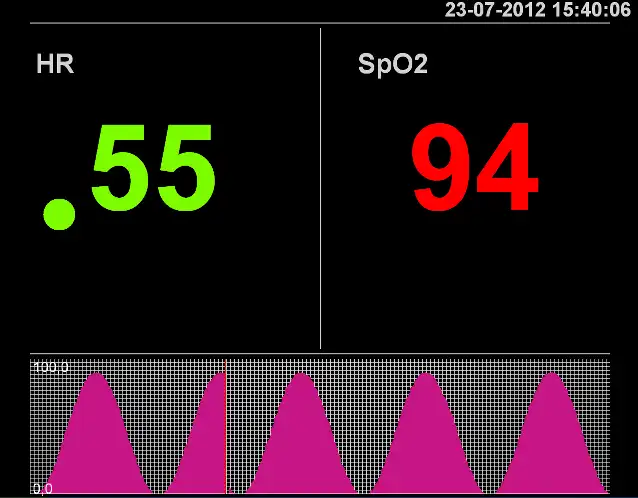 Download web tool or web app Patient Monitor