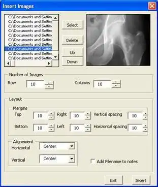 Download web tool or web app PowerPoint tools for the radiologist